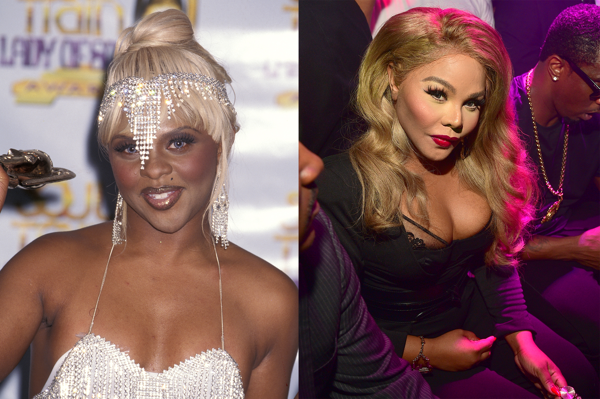 Lil Kim Plastic Surgery
