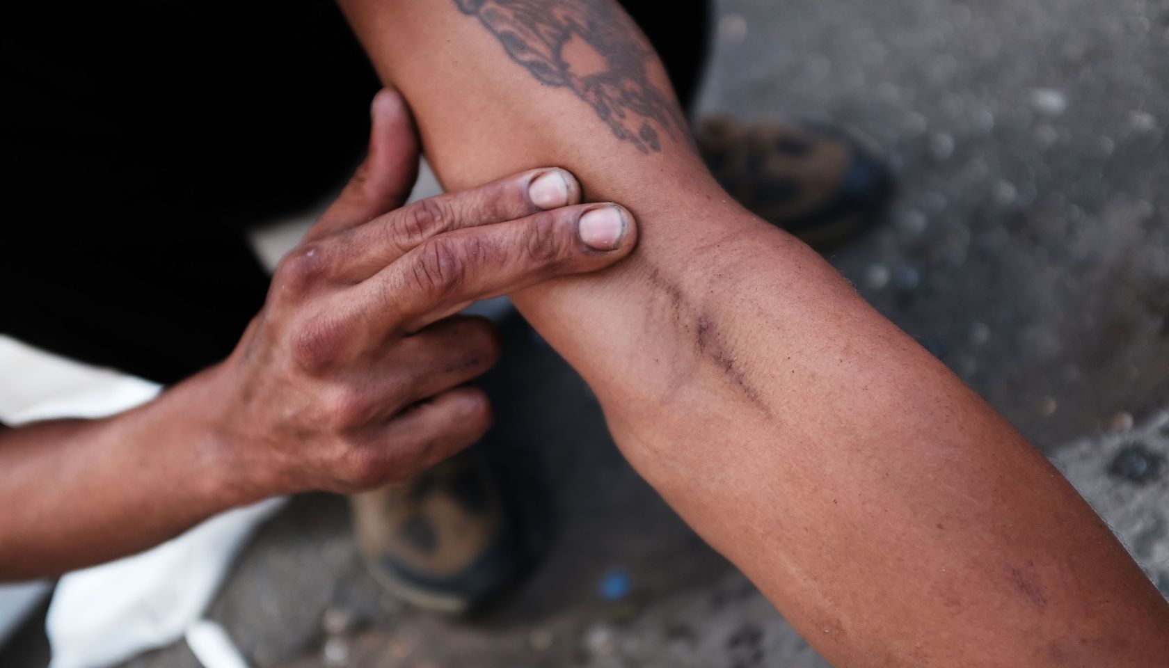 Opioid Epidemic Plagues Section Of Bronx Neighborhood