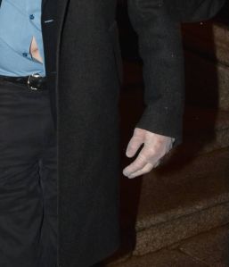 Steve Martin Wears Surgical Gloves in Dublin