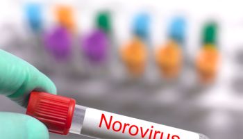 Testing sample of Norovirus in test tube